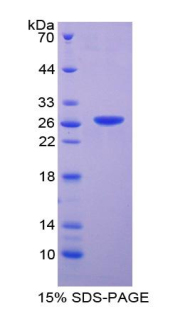 DNASE1L2 Protein - Recombinant Deoxyribonuclease I Like Protein 2 By SDS-PAGE