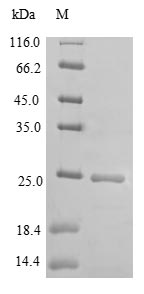 DOCK8 Protein - (Tris-Glycine gel) Discontinuous SDS-PAGE (reduced) with 5% enrichment gel and 15% separation gel.