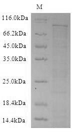 DPP4 / CD26 Protein - (Tris-Glycine gel) Discontinuous SDS-PAGE (reduced) with 5% enrichment gel and 15% separation gel.