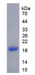 DPP4 / CD26 Protein - Recombinant Dipeptidyl Peptidase IV By SDS-PAGE