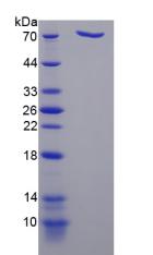 DPP9 Protein - Recombinant Dipeptidyl Peptidase 9 By SDS-PAGE
