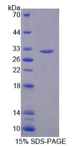 DPYD / DPD Protein - Recombinant Dihydropyrimidine Dehydrogenase By SDS-PAGE