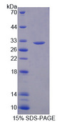 DPYD / DPD Protein - Recombinant Dihydropyrimidine Dehydrogenase By SDS-PAGE