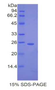 DSC1 / Desmocollin 1 Protein - Recombinant Desmocollin 1 By SDS-PAGE