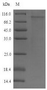 DSG2 / Desmoglein 2 Protein - (Tris-Glycine gel) Discontinuous SDS-PAGE (reduced) with 5% enrichment gel and 15% separation gel.
