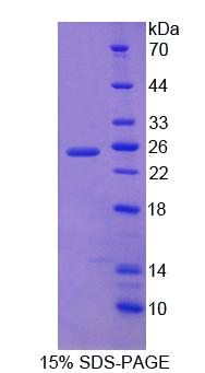 DTNBP1 / Dysbindin Protein - Recombinant Dystrobrevin Binding Protein 1 (DTNBP1) by SDS-PAGE
