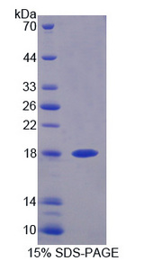 DUSP5 Protein - Recombinant Dual Specificity Phosphatase 5 By SDS-PAGE