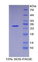 DVL1 / DVL / Dishevelled Protein - Recombinant Dishevelled, Dsh Homolog 1 By SDS-PAGE