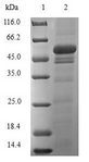 E6AP / UBE3A Protein - (Tris-Glycine gel) Discontinuous SDS-PAGE (reduced) with 5% enrichment gel and 15% separation gel.