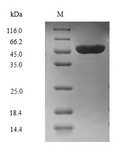 E6AP / UBE3A Protein - (Tris-Glycine gel) Discontinuous SDS-PAGE (reduced) with 5% enrichment gel and 15% separation gel.