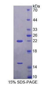 ECE2 Protein - Recombinant Endothelin Converting Enzyme 2 (ECE2) by SDS-PAGE