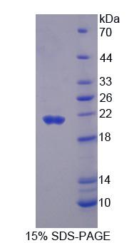 ECI2 / PECI Protein - Recombinant Peroxisomal D3, D2-Enoyl Coenzyme A Isomerase (PECI) by SDS-PAGE