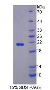 ECI2 / PECI Protein - Recombinant Peroxisomal D3, D2-Enoyl Coenzyme A Isomerase (PECI) by SDS-PAGE