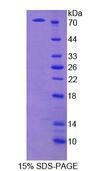 ECM1 Protein - Recombinant  Extracellular Matrix Protein 1 By SDS-PAGE