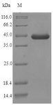 EFHD2 Protein - (Tris-Glycine gel) Discontinuous SDS-PAGE (reduced) with 5% enrichment gel and 15% separation gel.