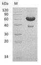 EFNA1 / Ephrin A1 Protein - (Tris-Glycine gel) Discontinuous SDS-PAGE (reduced) with 5% enrichment gel and 15% separation gel.