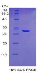 EGR2 Protein - Recombinant Early Growth Response Protein 2 By SDS-PAGE