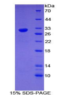 EGR4 / EGR-4 Protein - Recombinant Early Growth Response Protein 4 By SDS-PAGE