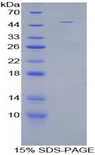 EMA / MUC1 Protein - Recombinant Mucin 1 By SDS-PAGE