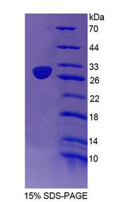 EMILIN2 Protein - Recombinant  Elastin Microfibril Interface Located Protein 2 By SDS-PAGE