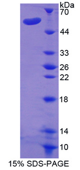 ENPEP / Aminopeptidase A Protein - Recombinant  Glutamyl Aminopeptidase By SDS-PAGE