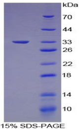 EP300 / p300 Protein - Recombinant E1A Binding Protein P300 By SDS-PAGE