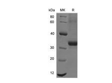 EPCAM Protein - Recombinant Mouse EpCAM Protein (His Tag)-Elabscience
