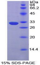 EPHA1 / EPH Receptor A1 Protein - Recombinant Ephrin Type A Receptor 1 By SDS-PAGE