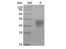 EPO / Erythropoietin Protein - Recombinant Mouse Erythropoietin/EPO (C-6His)