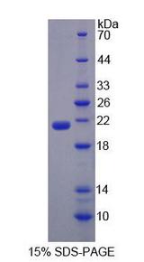 EPRS / PARS Protein - Recombinant Glutamyl Prolyl tRNA Synthetase (EPRS) by SDS-PAGE