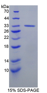 ERBB3 / HER3 Protein - Recombinant  V-Erb B2 Erythroblastic Leukemia Viral Oncogene Homolog 3 By SDS-PAGE