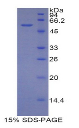 ERG-1 / CUZD1 Protein - Recombinant CUB And Zona Pellucida Like Domains Protein 1 By SDS-PAGE