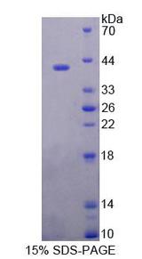 ERP44 Protein - Recombinant Endoplasmic Reticulum Protein 44 (ERP44) by SDS-PAGE