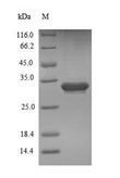 ESM1 / Endocan Protein - (Tris-Glycine gel) Discontinuous SDS-PAGE (reduced) with 5% enrichment gel and 15% separation gel.