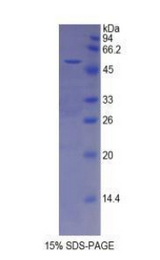 ESM1 / Endocan Protein - Recombinant Endothelial Cell Specific Molecule 1 By SDS-PAGE