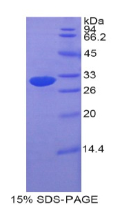 ETFA Protein - Recombinant Electron Transfer Flavoprotein Alpha Polypeptide By SDS-PAGE