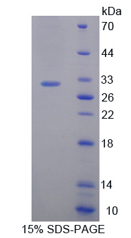 ETK / BMX Protein - Recombinant  BMX Non Receptor Tyrosine Kinase By SDS-PAGE