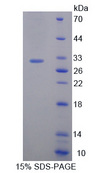 ETK / BMX Protein - Recombinant  BMX Non Receptor Tyrosine Kinase By SDS-PAGE