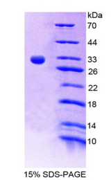 F13A1 / Factor XIIIa Protein - Recombinant Coagulation Factor XIII A1 Polypeptide By SDS-PAGE
