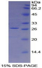 F3 / CD142 / Tissue factor Protein - Recombinant Tissue Factor By SDS-PAGE