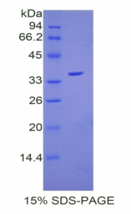 F5 / Factor Va Protein - Recombinant Coagulation Factor V By SDS-PAGE
