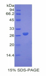 F9 / Factor IX Protein - Recombinant Coagulation Factor IX By SDS-PAGE