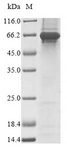 FAM20C Protein - (Tris-Glycine gel) Discontinuous SDS-PAGE (reduced) with 5% enrichment gel and 15% separation gel.