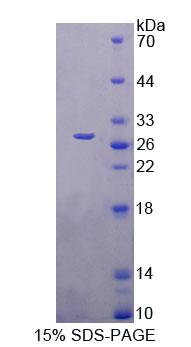 FBLN7 / Fibulin 7 Protein - Recombinant Fibulin 7 (FBLN7) by SDS-PAGE