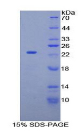 FBN1 / Fibrillin 1 Protein - Recombinant Fibrillin 1 By SDS-PAGE