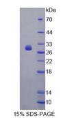 FBS1 Protein - Recombinant Fibrosin (FBS) by SDS-PAGE