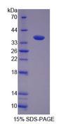 FBXL3 Protein - Recombinant  F-Box And Leucine Rich Repeat Protein 3 By SDS-PAGE