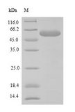 FBXW10 Protein - (Tris-Glycine gel) Discontinuous SDS-PAGE (reduced) with 5% enrichment gel and 15% separation gel.