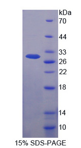 F‑box/WD‑40 repeat‑containing protein 7: A potential 