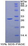 FCGR1A / CD64 Protein - Recombinant Receptor I For The Fc Region Of Immunoglobulin G By SDS-PAGE